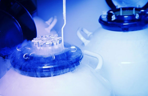 Embryo-Freezing Embryo-Freezing