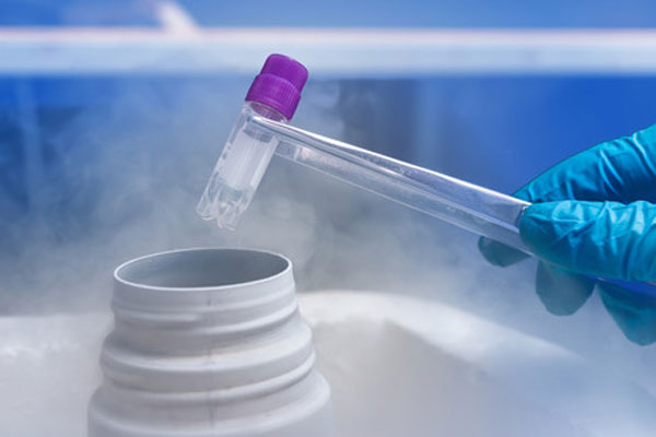 cryopreservation cryopreservation