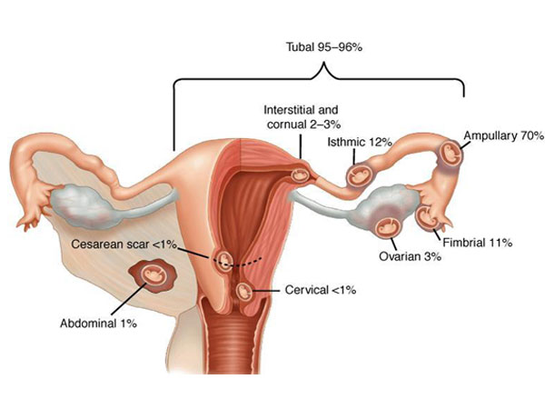 diminished-ovarian-reserve-img1-delhi-ivf diminished-ovarian-reserve-img1-delhi-ivf