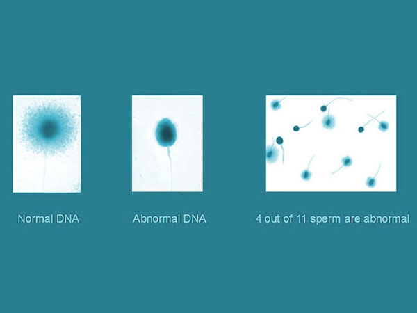 dna-fragmentation-img1-delhi-ivf dna-fragmentation-img1-delhi-ivf