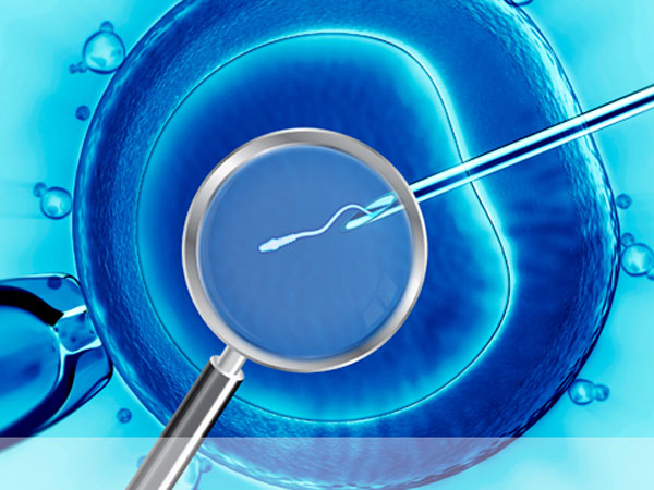 imsi-img1-delhi-ivf imsi-img1-delhi-ivf