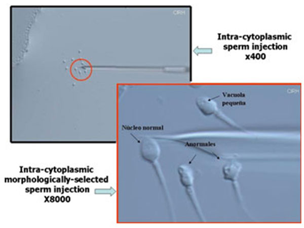 imsi-img1-delhi-ivf imsi-img1-delhi-ivf